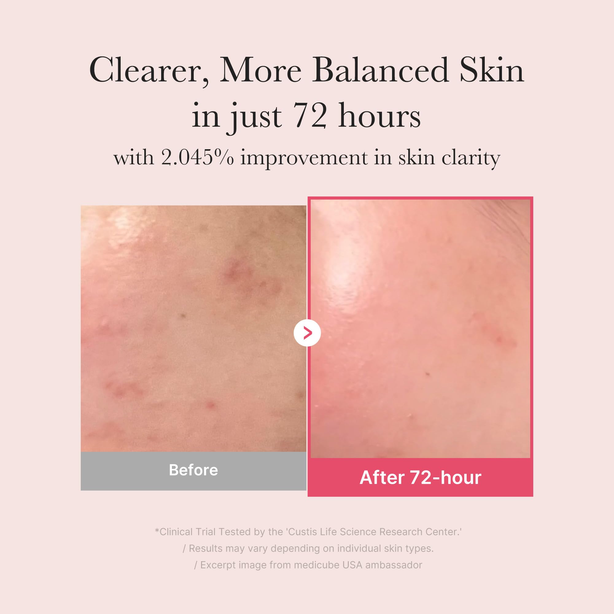 Medicube TXA Niacinamide 15 Serum - GlossyGlams