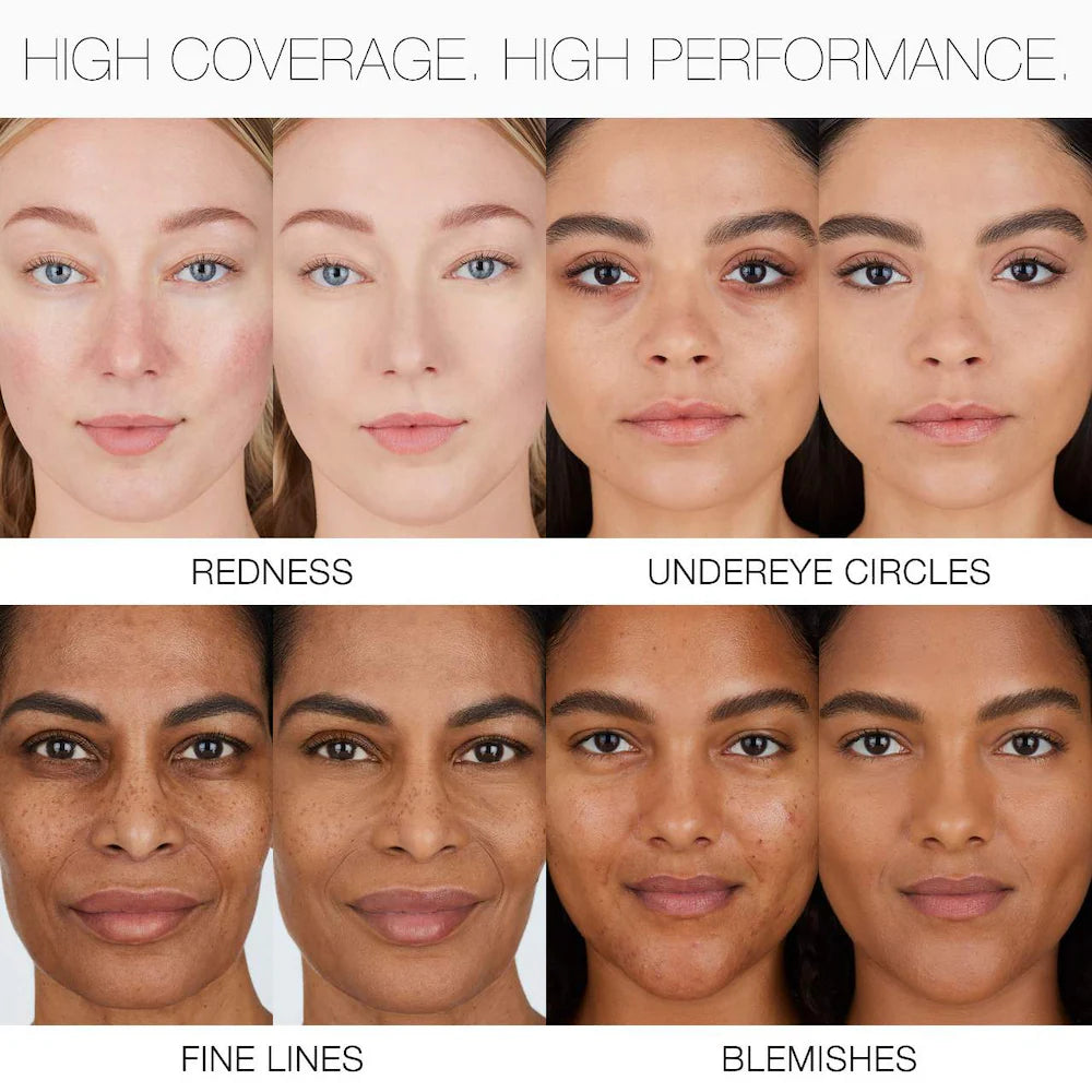 A before-and-after comparison grid showing skin improvement results for redness, undereye circles, fine lines, and blemishes, with six facial close-ups arranged in two rows and text labels below each panel.