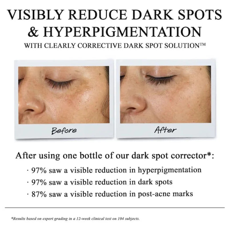 Kiehl's Clearly Corrective Dark Spot Solution