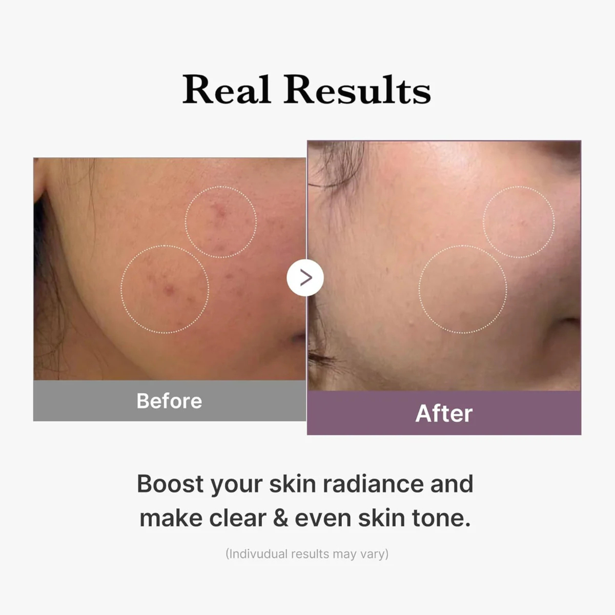 Medicube Age-R Glutathione Glow Toner 140ml