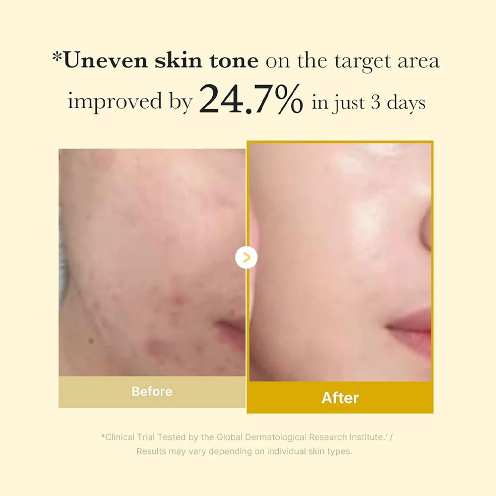 Before and after comparison of skin tone improvement with text indicating a 24.7% improvement in 3 days.